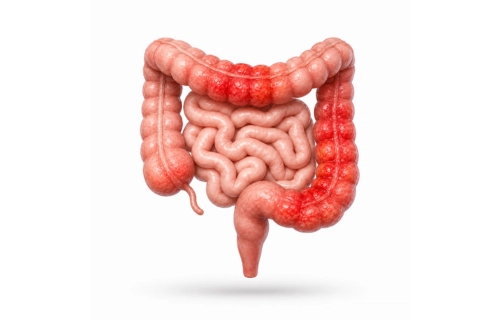Gastroenterologo Queretaro citas