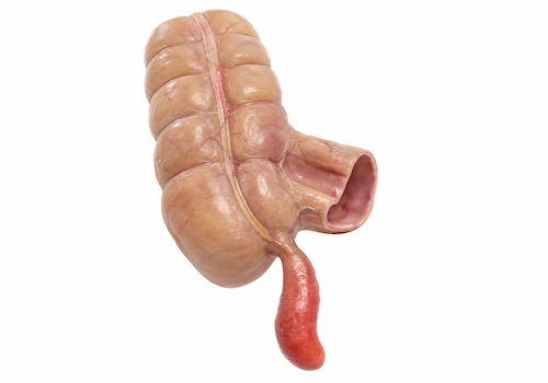 Gastroenterologo para apendicitis Queretaro