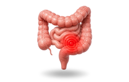 Gastroenterologo para dolor intestinal Queretaro